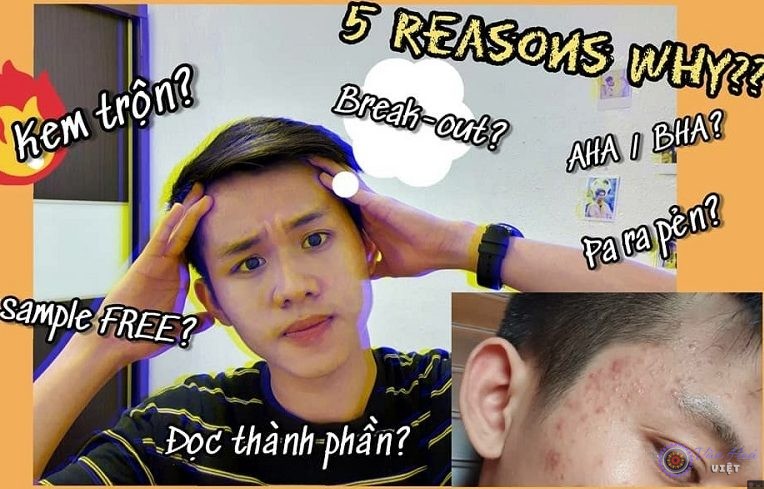 Beauty Blogger từng khủng hoảng vì mụn