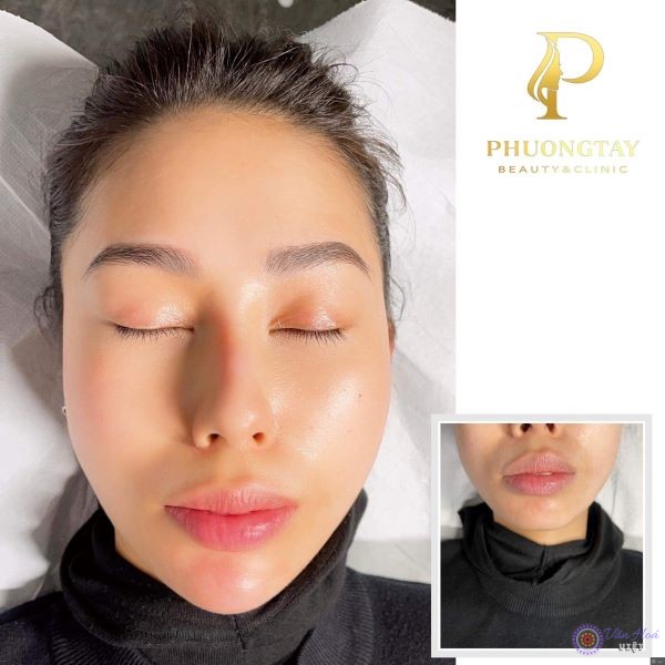 Khách sử dụng dịch vụ tại Phương Tây Beauty