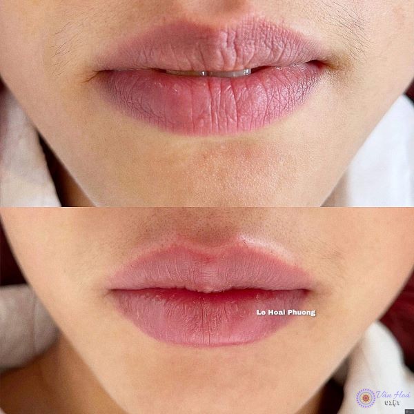 Phương Tây Beauty của CEO Lê Hoài Phương luôn dành chất lượng dịch vụ tốt nhất dành cho khách hàng
